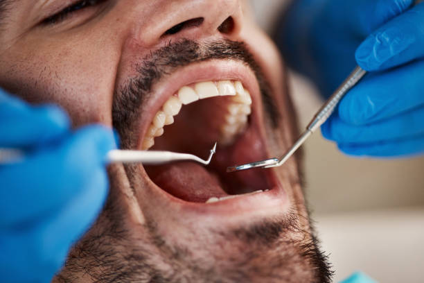 Best After-Hours Emergency Dentist in Lone Grove, OK